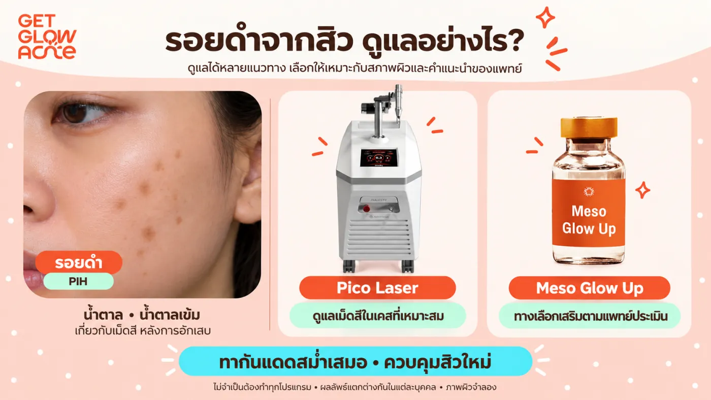 รอยดำจากสิว (PIH) ดูแลอย่างไร — Pico Laser ดูแลเม็ดสีในเคสที่เหมาะสม และ Meso Glow Up เป็นทางเลือกเสริมตามแพทย์ประเมิน