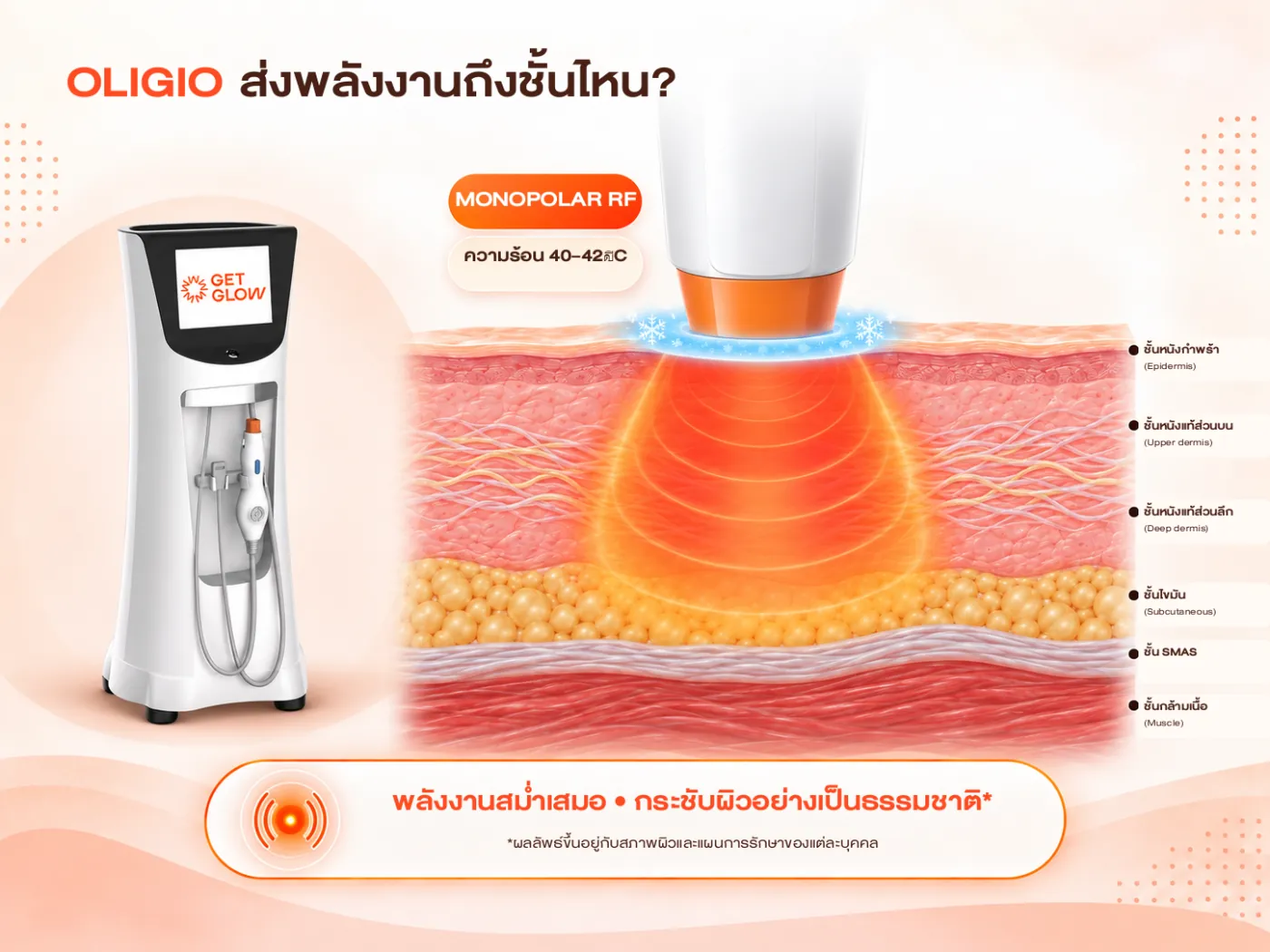 อินโฟกราฟิก OLIGIO ส่งพลังงานถึงชั้นไหน — Monopolar RF ความร้อน 40–42 องศาเซลเซียส กระจายถึงชั้นหนังแท้และไขมัน